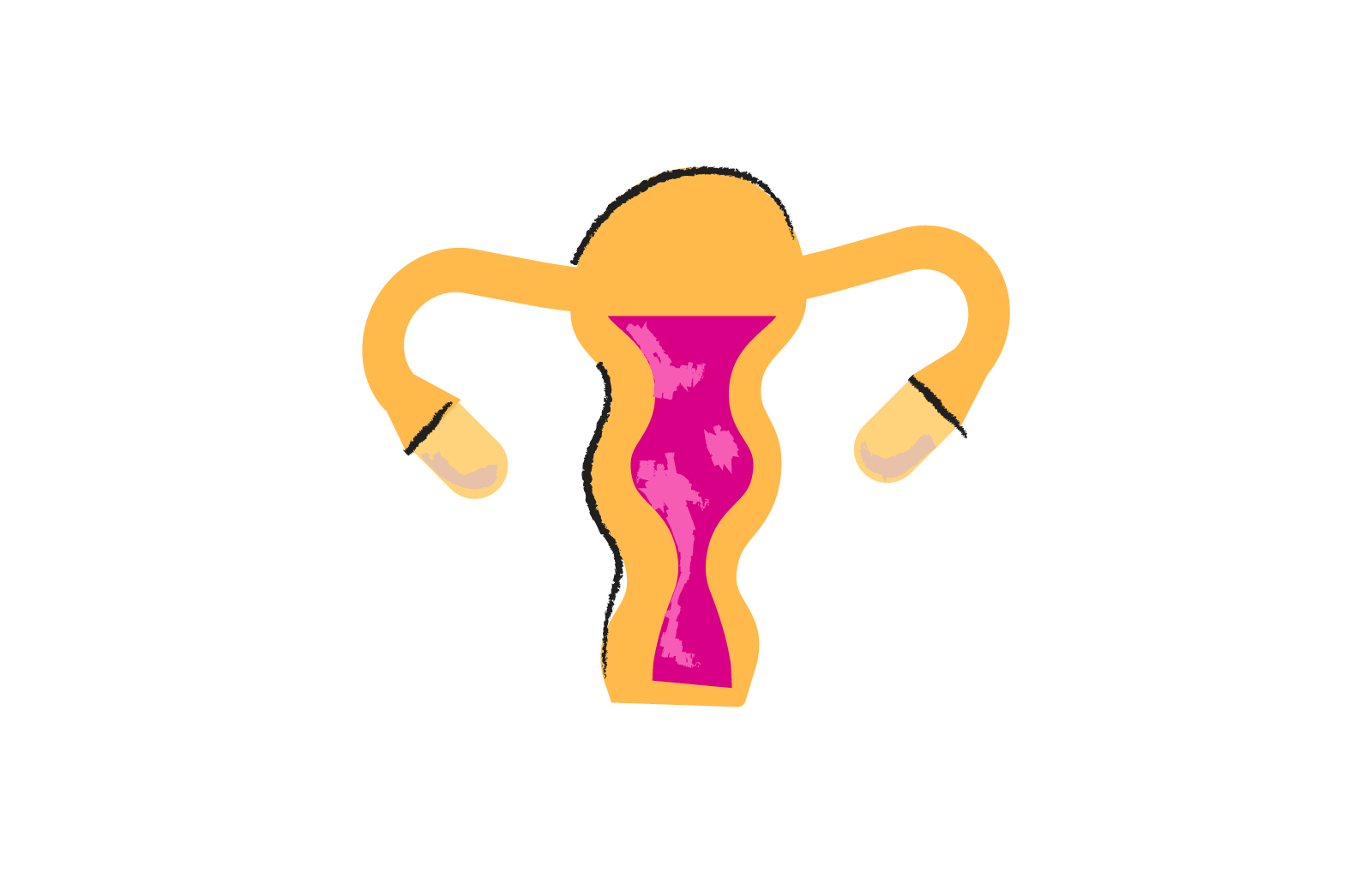 58% опитаних українок зіткнулись із порушеннями менструального циклу у зоні бойових дій