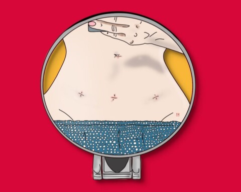 Видалення матки, відгук жінки