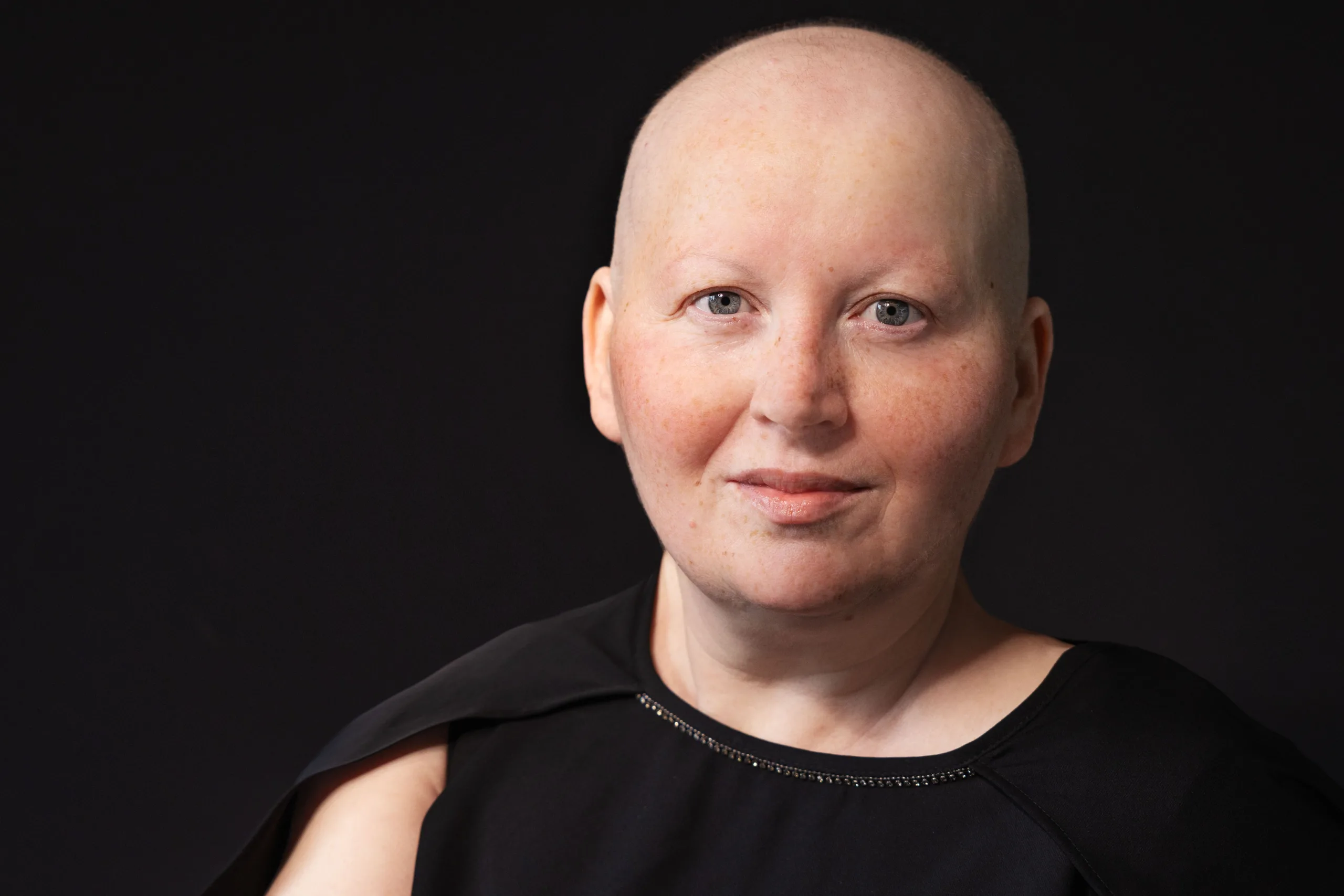 «Ми такі ж, як всі, хіба трохи інші». Досвід харків’янки, що виїхала для лікування раку за кордон