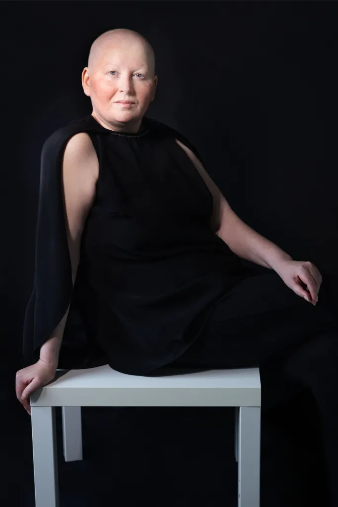 «Ми такі ж, як всі, хіба трохи інші». Досвід харків’янки, що виїхала для лікування раку за кордон