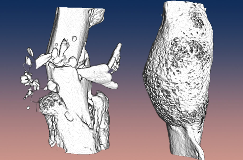 Вчені виявили новий гормон, що виробляється під час грудного вигодовування і може допомогти у лікуванні остеопорозу