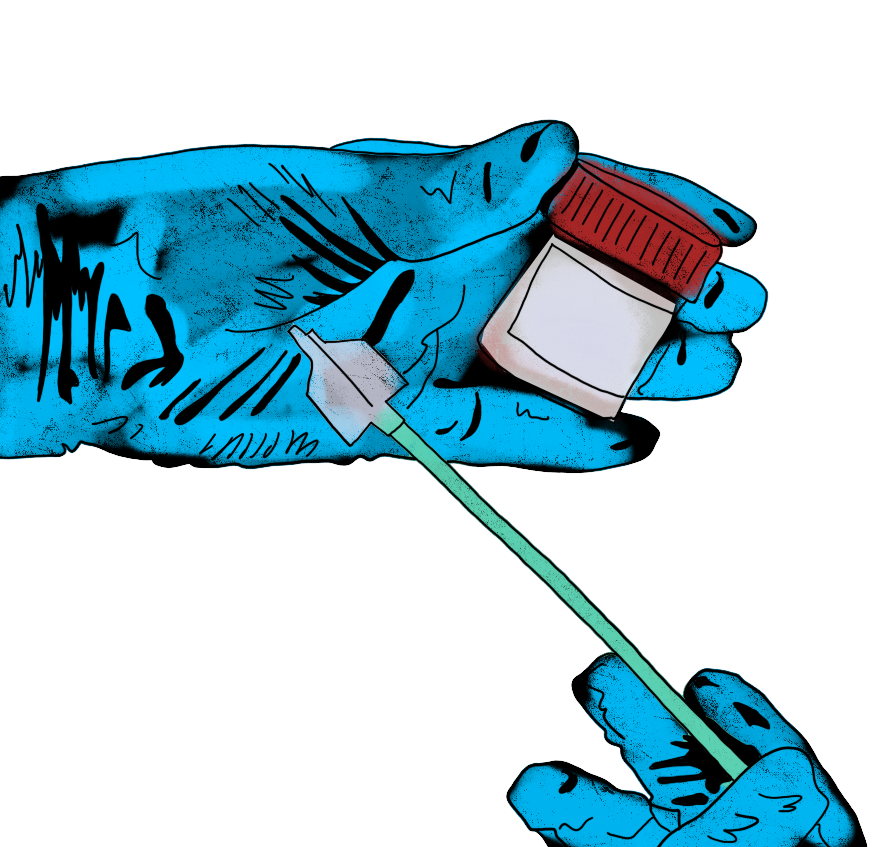 Скринінг раку шийки матки: Коли здавати ПАП-тест і як готуватися до процедури