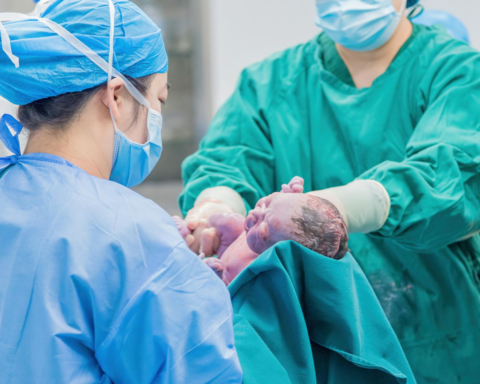 Вчені заявили про катастрофічну нестачу акушерок у світі