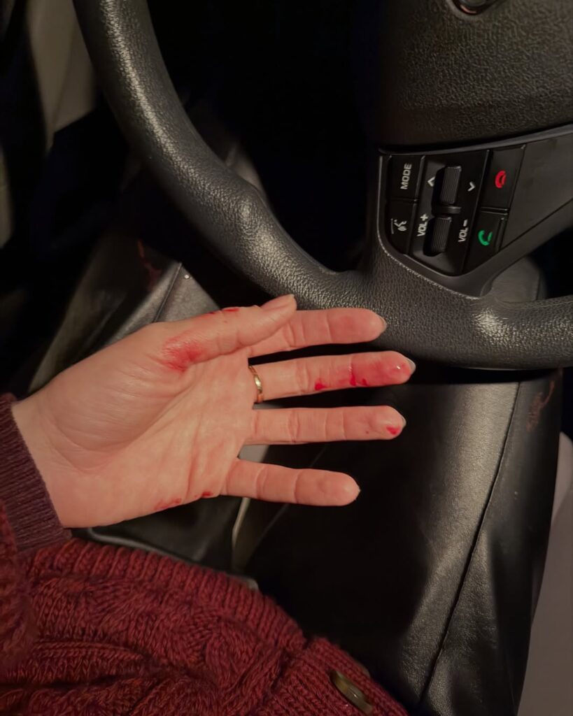 «Бив ногами в живіт та душив»: мешканка Київщини заявила про напад колишнього чоловіка та ігнорування справи поліцією. Оновлено