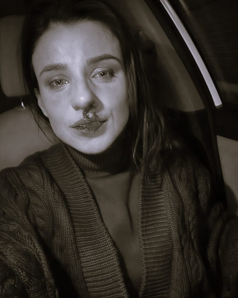 «Бив ногами в живіт та душив»: мешканка Київщини заявила про напад колишнього чоловіка та ігнорування справи поліцією. Оновлено