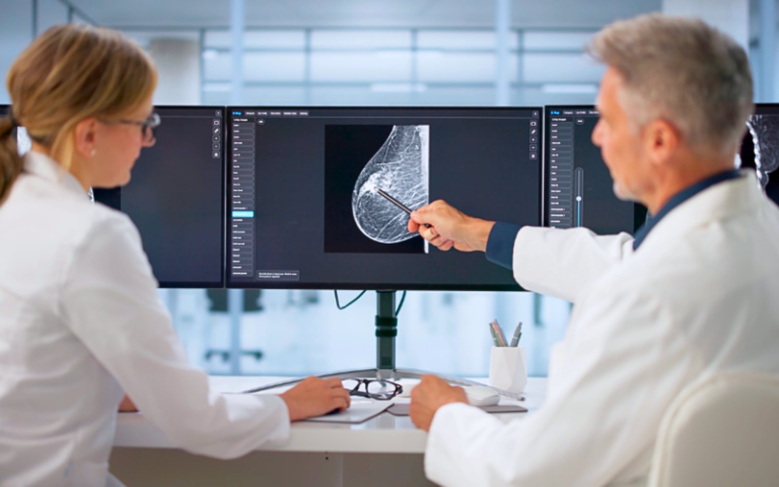 Новий ДНК-тест змінить підхід до лікування раку грудей: тисячі жінок зможуть уникнути хімієтерапії — дослідження
